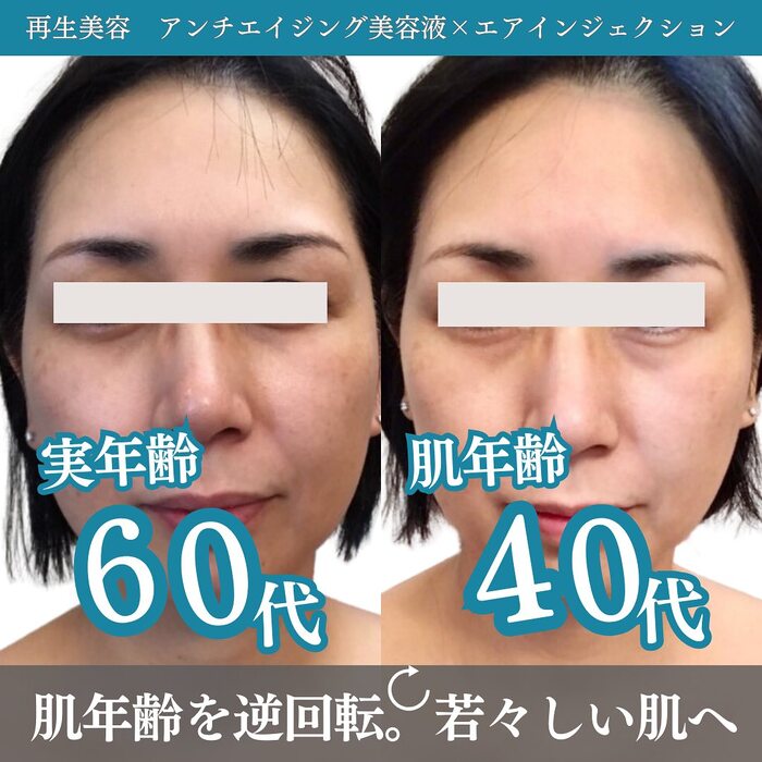 画像330