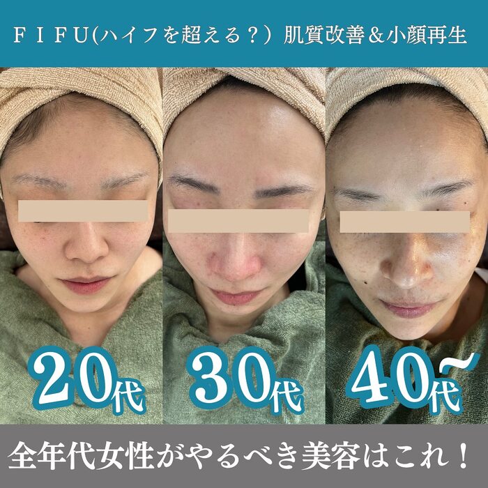 画像363