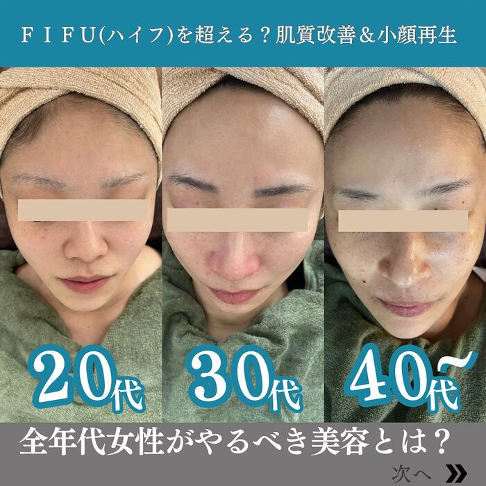 画像376