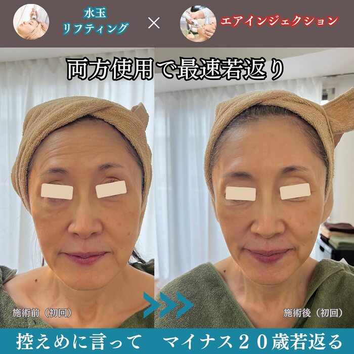 画像456