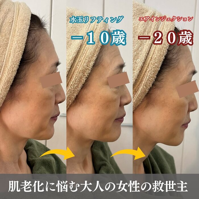 画像466