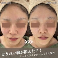 画像614