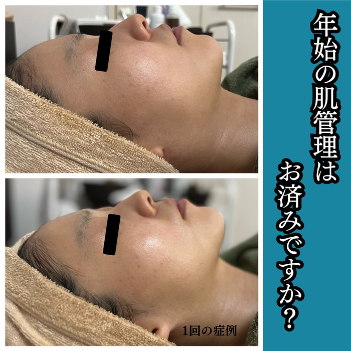 画像660