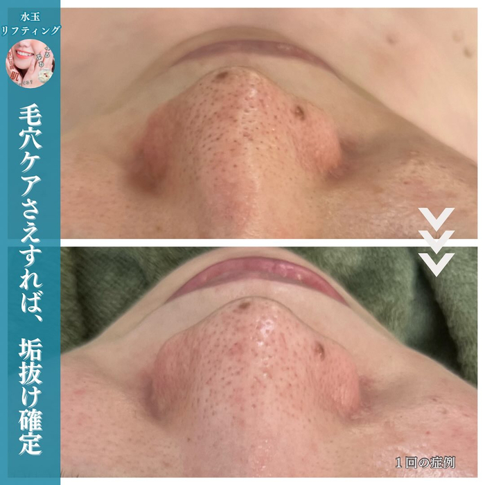 画像887