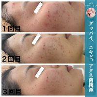 画像889